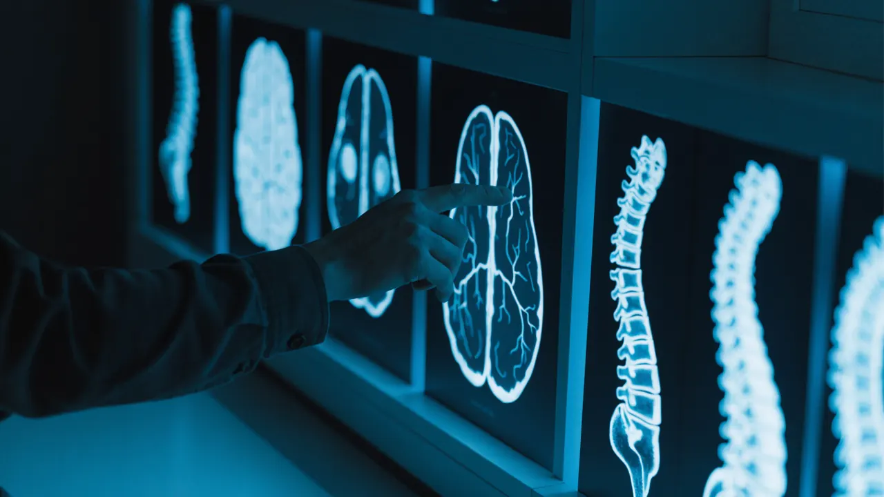 Estudios de imagen cerebral sobre un escritorio médico — lesiones cerebrales y de médula
